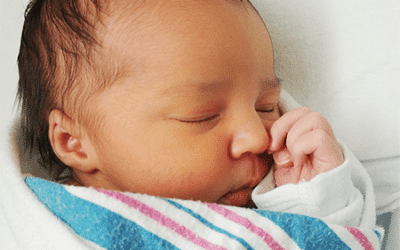 Factsheet – Neonatal Jaundice
