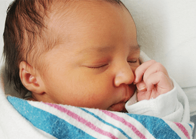 Factsheet – Neonatal Jaundice