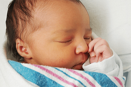 Factsheet – Neonatal Jaundice
