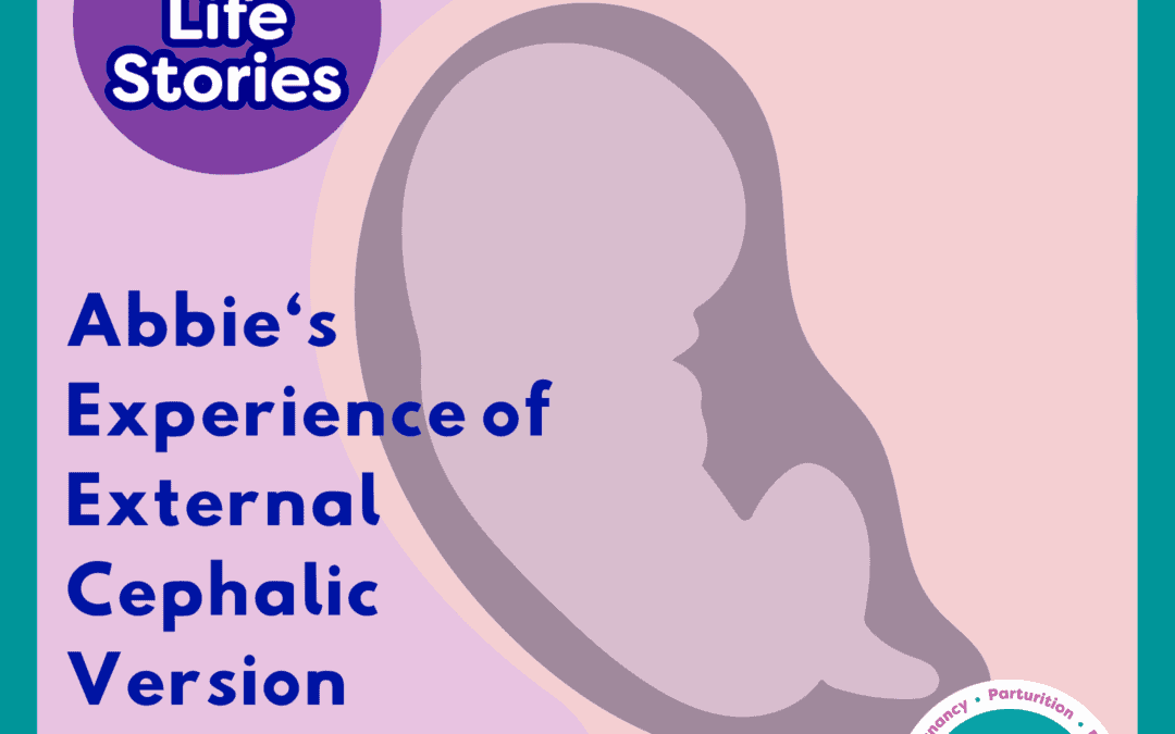Abbie’s Experience of External Cephalic Version (ECV) at 37 Weeks