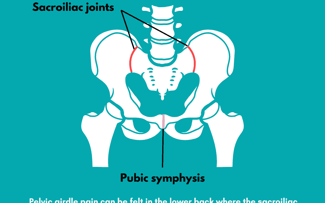 Factsheet- Managing Pelvic Girdle Pain (PGP) in Pregnancy