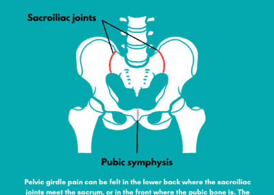 Factsheet- Managing Pelvic Girdle Pain (PGP) in Pregnancy