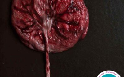 Unveiling the Marvels of the Third Stage of Labor: Understanding Physiology and Anatomy of the Birth of the Placenta and Optimal Cord Clamping